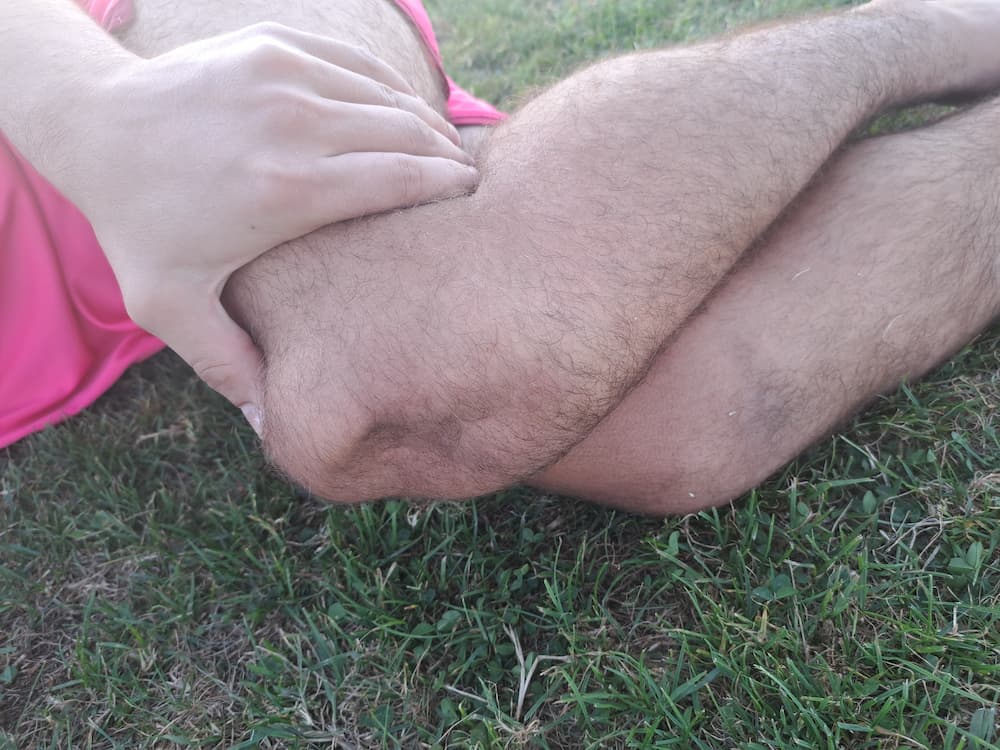 Iščašenje patele kod djece i adolescenata